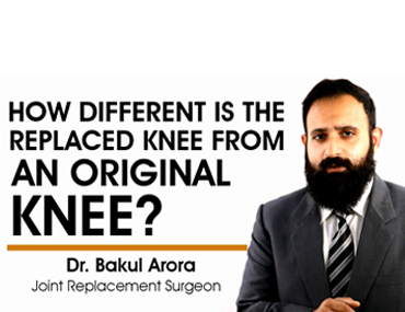 Difference between replaced knee and original knee.