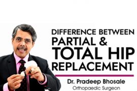 Difference between Partial & Total Hip Replacement Surgery - Dr. Pradeep Bhosale (Orthopaedic Surgeon)