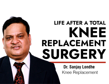 Life after a Total Knee Replacement Surgery