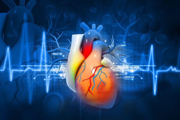 TAVR is an alternative to open heart surgery