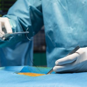 Importance of Using the Correct Suture and Needle Type in Different Surgeries