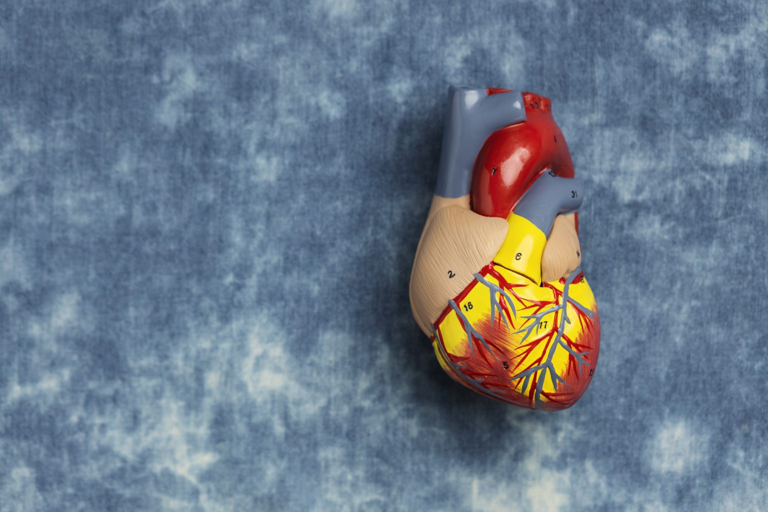 Life Expectancy After Stenting Add More To Life Meril Life Expectancy After Stenting Add More To Life Meril