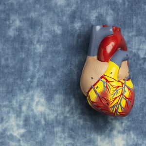 Everything You Need to Know About Coronary Artery Disease