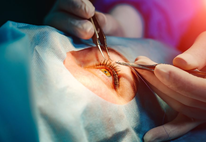 What Makes Suture Relevant in Ophthalmic Surgery in the Age of Lasers?