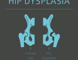 Hip Dysplasia
