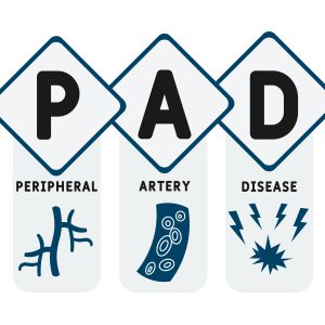 Understanding Peripheral artery disease: Risk Factors, Complications and Prevention