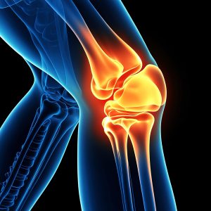 The Most Common Joint Health Issues and How to Manage Them