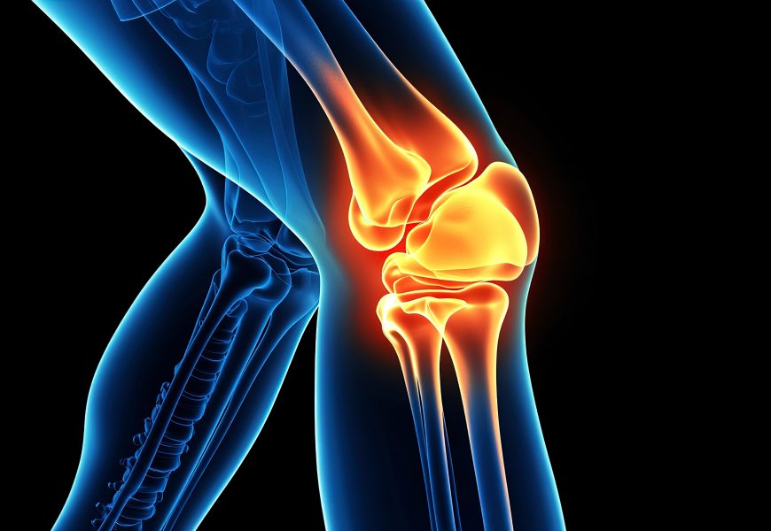 The Most Common Joint Health Issues and How to Manage Them