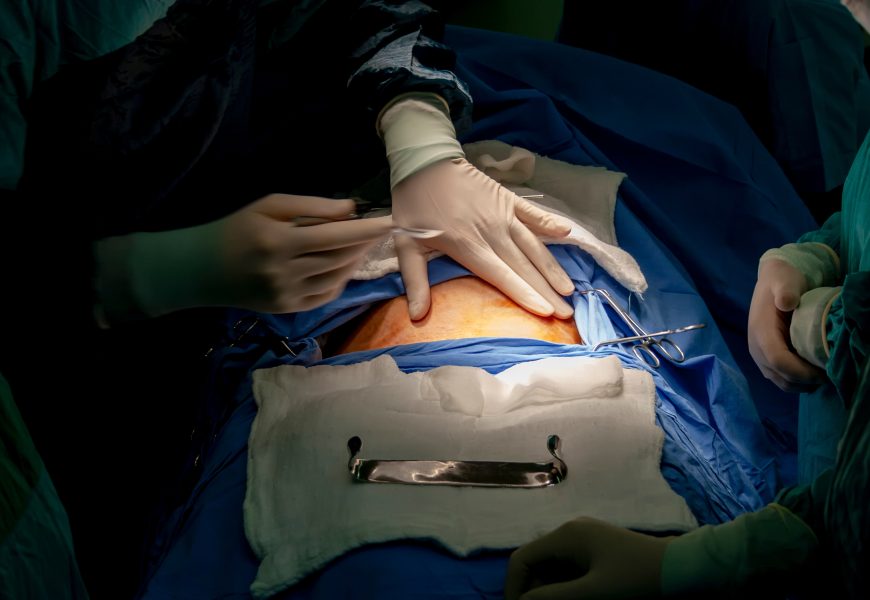 When is a C-Section Necessary? Reasons and Considerations