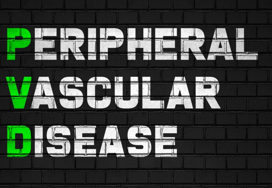 Peripheral Vascular Disease: How to Recognize and Manage It Early